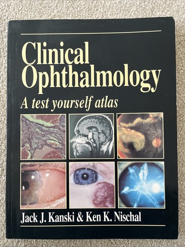 Clinical ophthalmology test - a,