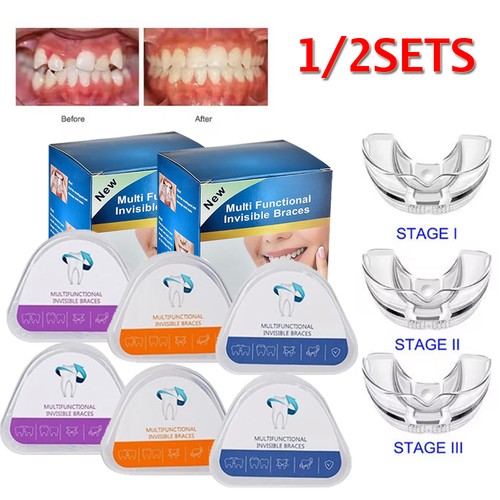 Orthodontic braces appliance - braces,