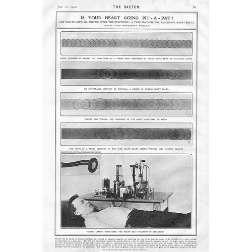 Edwardian heart beat recorder - beat,