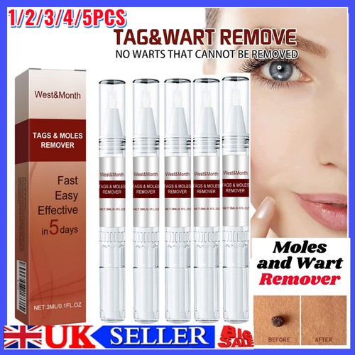Wart remover liquid - wart,