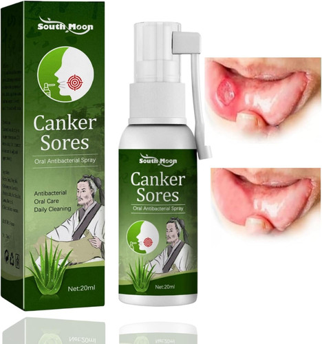 Mouth ulcer treatment - mouth,