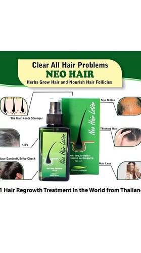 Neo hair lotion 120ml 100 - lotion, 100%