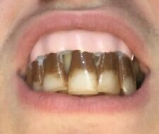 Fake Teeth Joke Dentures Prank