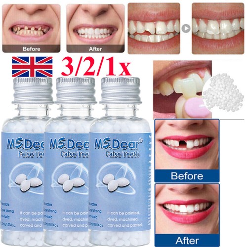 Tooth repair beads - beads, granules
