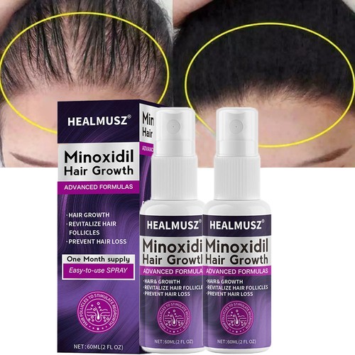 Minoxidil hair regrowth - minoxidil,