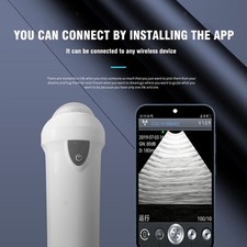Wireless Veterinary Ultrasound