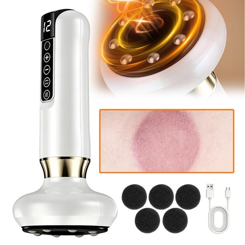 Electric vacuum cupping - electric,