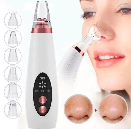 Usb blackhead remover vacuum - usb,