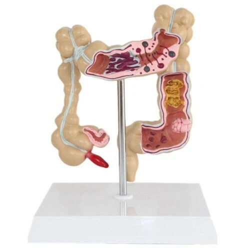 Anatomical human colon - human,