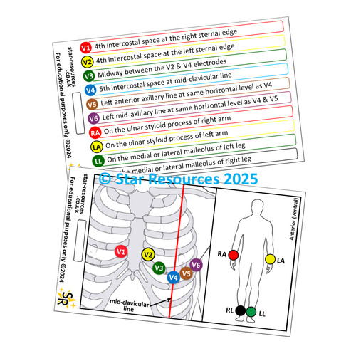 Ecg lead placement badge - lead,