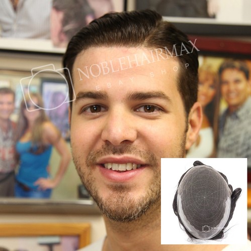 High hair replacement system - high,