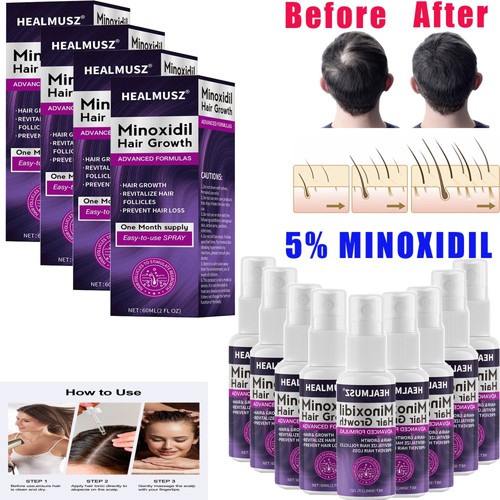 Minoxidil for women - minoxidil,