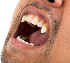 250G Mouldable Polymorph