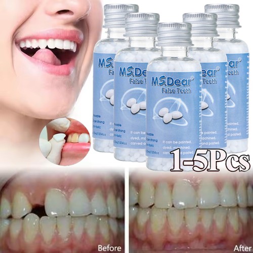 Temporary tooth repair kit - tooth,