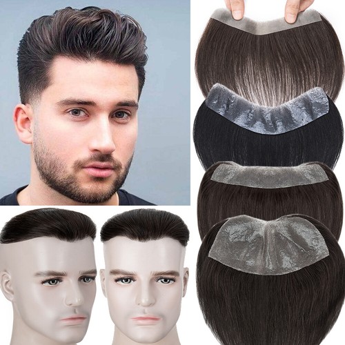 Forehead hairline skin mens - skin, pu