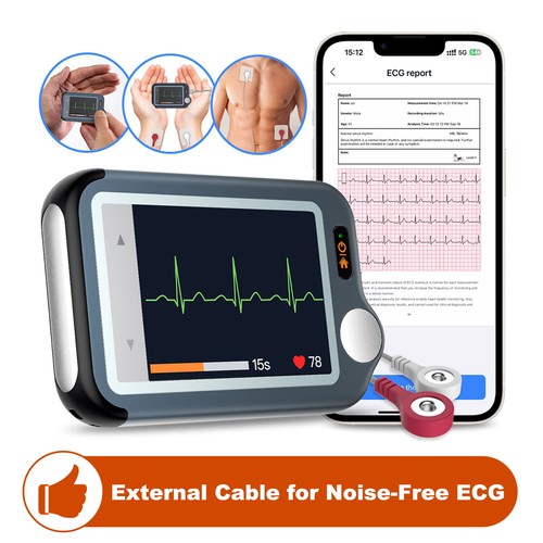 Checkme bluetooth ekg - ex,
