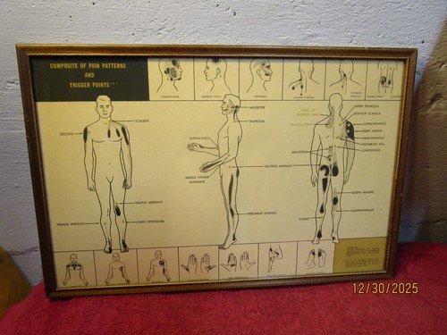 Vintage composite pain - vintage,