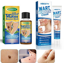 Wart Removal Body Mole Warts Treatment Cream Foot Care Skin Tag Remover Verruca