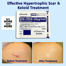 Genuine Hisamitsu Eclar