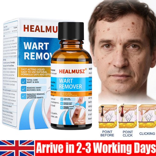 Wart remover liquid - liquid,, fast