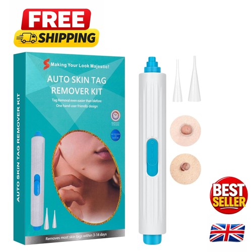 Gentle cryotag skin tag - cryotag,