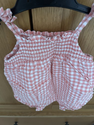 Billie faiers baby girl burnt - billie,