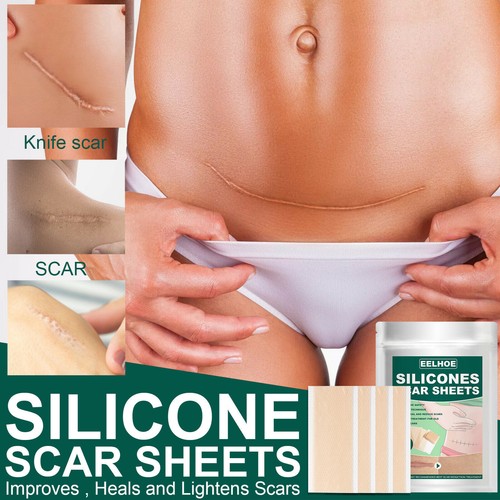 Silicone scar sheet - silicone,