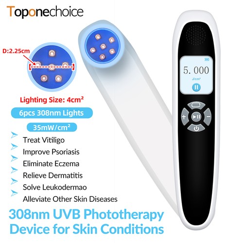 Handheld 308nm narrowband uvb - handheld,