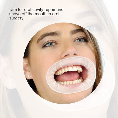 10pcs rubber mouth opener - 10pcs,