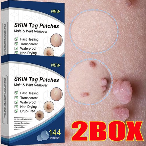 Skin tag remover patches - skin,