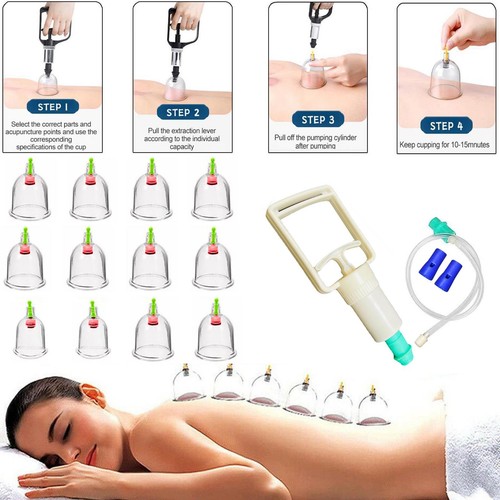 12pcs vacuum cupping set - 12pcs,