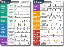 EKG Rhythm Interpretation