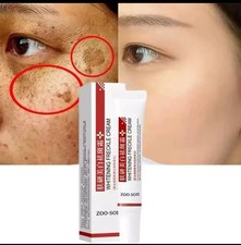 Whitening Freckles Spot