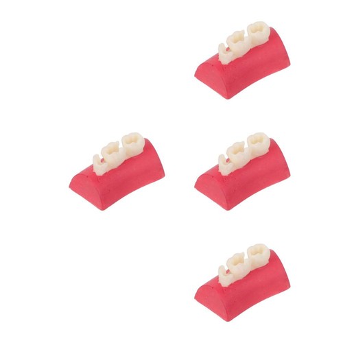 4pcs dental root canal filling - root,