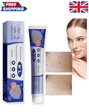 STRONG SKIN TAG REMOVER Cream NATURAL TREATMENT MOLES WARTS and TAGS