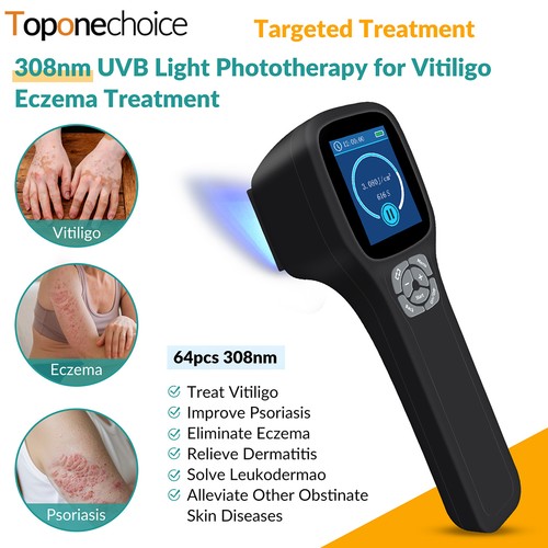 308nm uvb phototherapy lamp - 308nm,