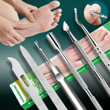 Professional  Ingrown Toenail
