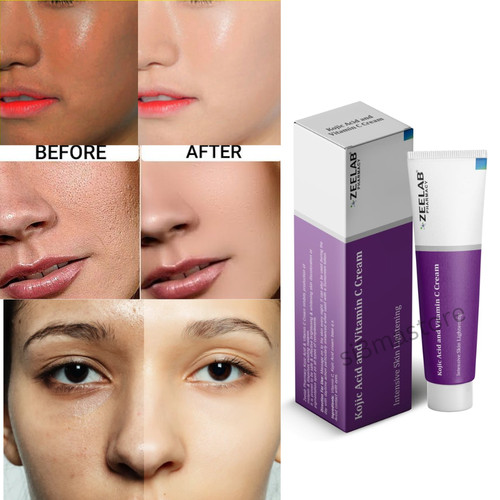 Skin lightening cream - , with
