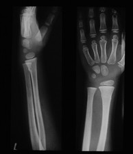 Magic Lantern Slide ROYAL FREE HOSPITAL LONDON XRAY NO7 C1950 VINTAGE PHOTO