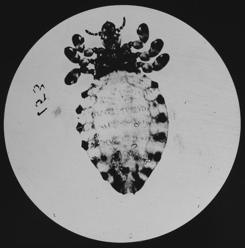 Human body louse - human,