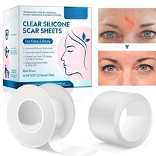 Medical Silicone Scar Tape