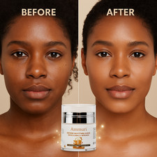 Extreme Whitening Face Cream Dark Spots Blemishes Bikini Under Arms Full Body