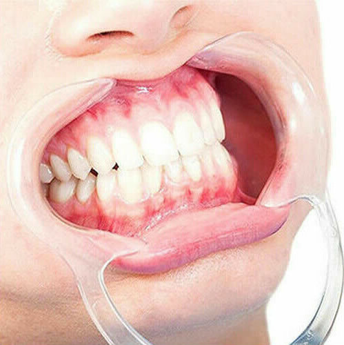 Open mouth drool gag oral - mouth,