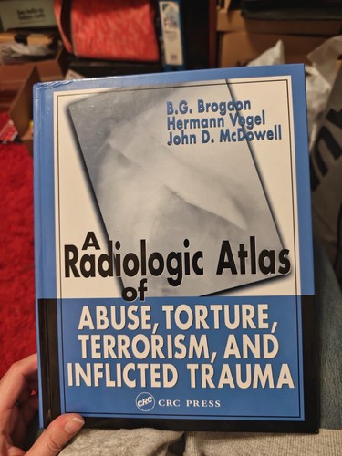 Radiologic atlas abuse - of,