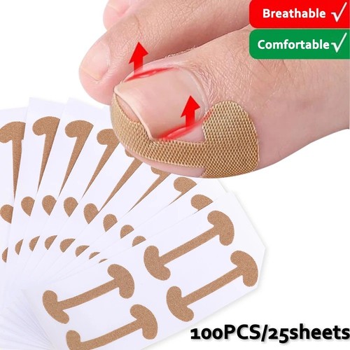 100pcs ingrown toenail - 100pcs,