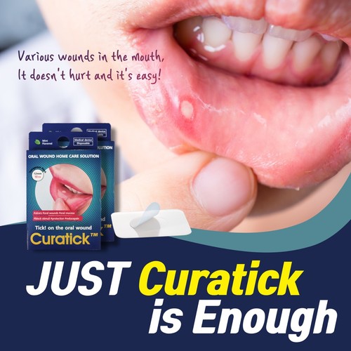 Mouth ulcer patches 10pcs - ulcer,