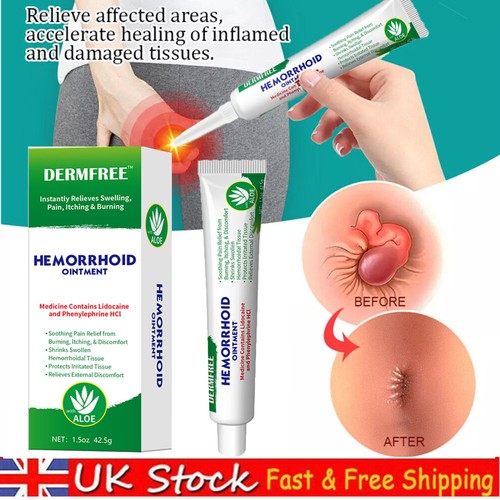 Hemorrhoid cream haemorrhoids - cream,