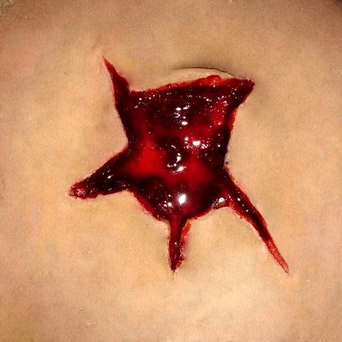 Hole wound deep - #1,