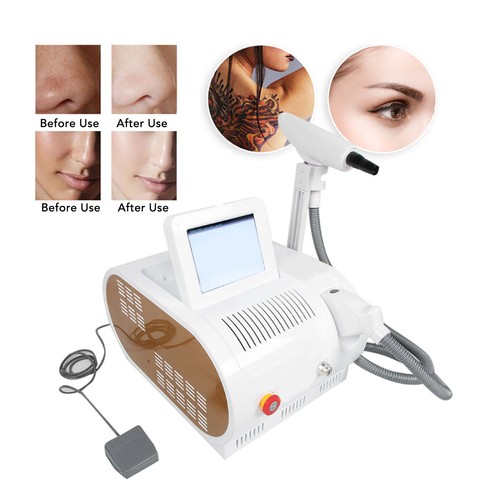 Hole tattoo removal machine - 3,