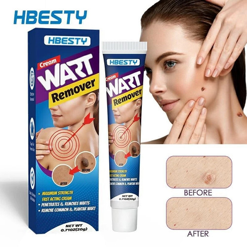 Hbesty wart removal - hbesty, ointment